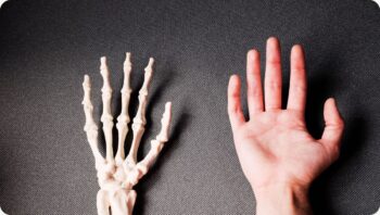 Handtherapie Frakturenkurs